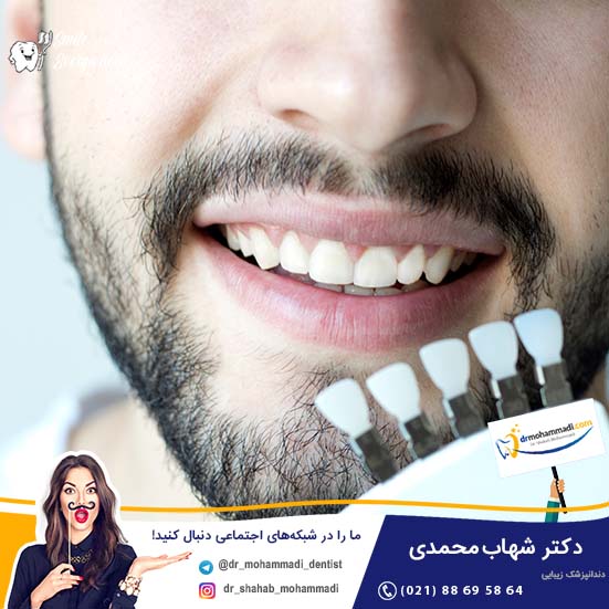 کدام روش بهتر است ارتودنسی یا کامپوزیت؟  - کلینیک دندانپزشکی دکتر شهاب محمدی